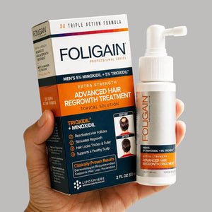 The Benefits of Using Minoxidil with Other Treatments