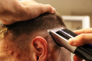 Effective Minoxidil Treatments for Men