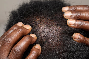 Effective Hair Growth Kits for Men with TRIOXIDIL®